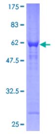 SDS-PAGE (CHMP2A-1249H).jpg